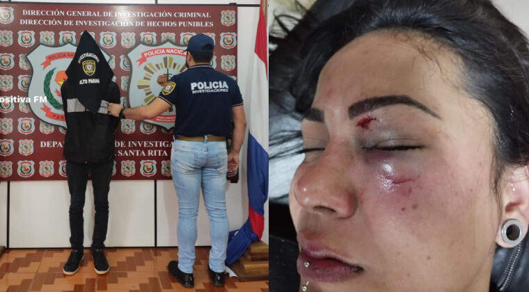 Santa Rita: detienen a joven que golpeó brutalmente y desfiguró la cara a su novia