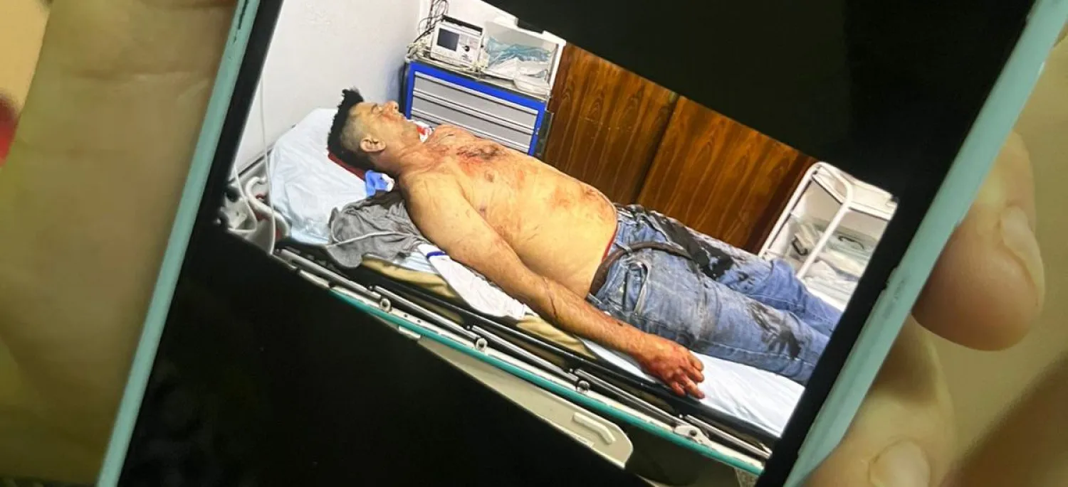 Comerciante es asesinado a balazos en Pedro Juan
