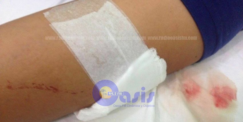 Pelea de mujeres deja a una de ella con herida de bala en Pedro Juan