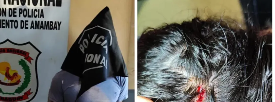 Tras haber agredigo a su hermana con una botella, hombre de 34 años resultó aprehendido