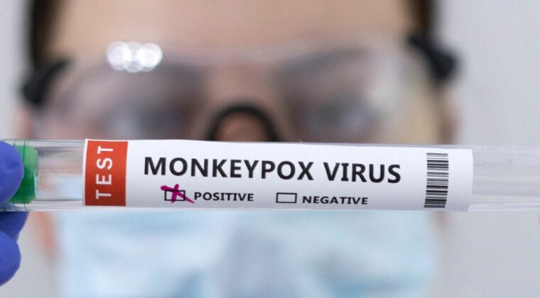 Sin nuevos casos confirmados de viruela símica, reportan