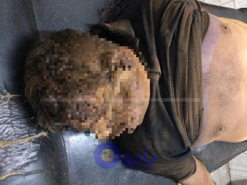 Hallan cadáver de una persona de 50 años que había sido arrollado en zona de Pedro Juan 