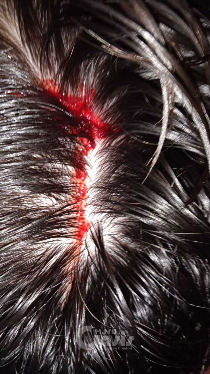 Inseguridad en Pedro Juan y falta de acción policial