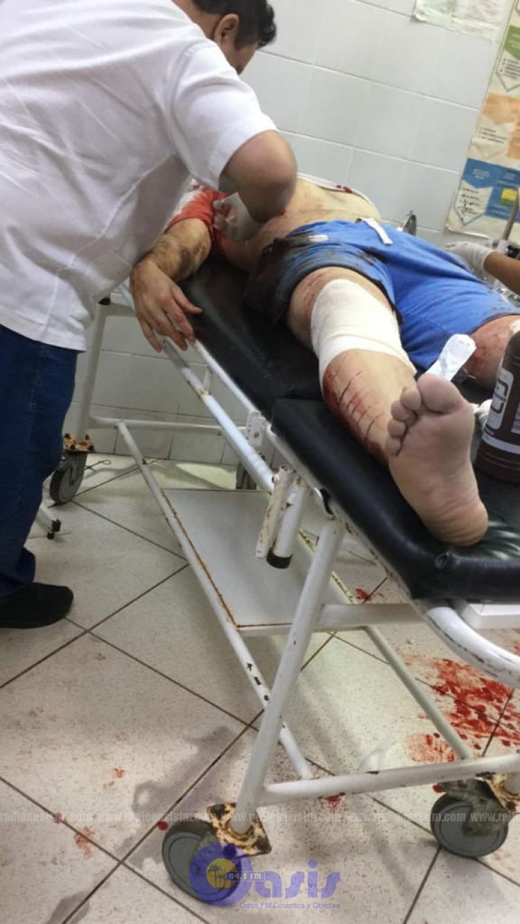 Balacera con  muerto y heridos en Capitán Bado