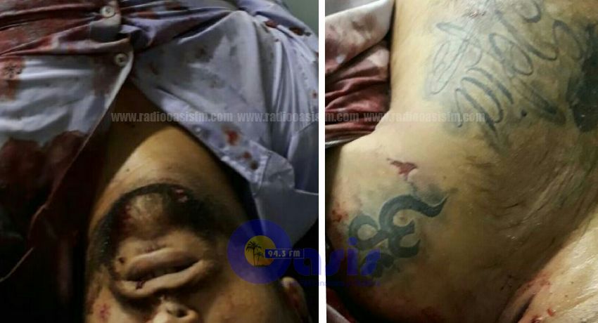 Buscan identificar cadáver  ejecutado  en Cnel. Sapucaia