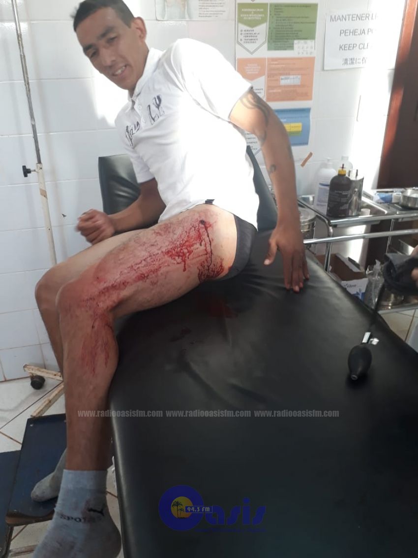 Intento de homicidio en Capitán Bado