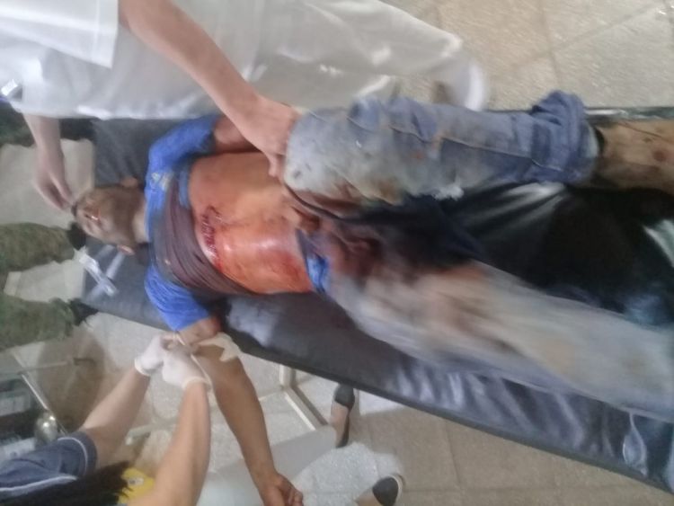 Disparan conta un hombre en Yby Yaú