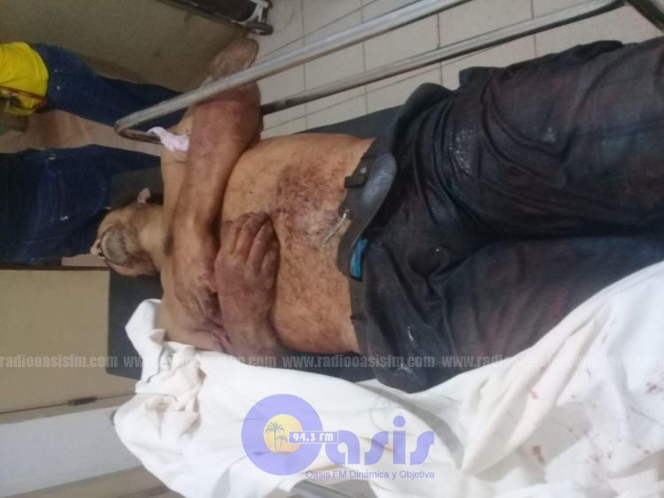 Matan a hombre en zona de Bella Vista