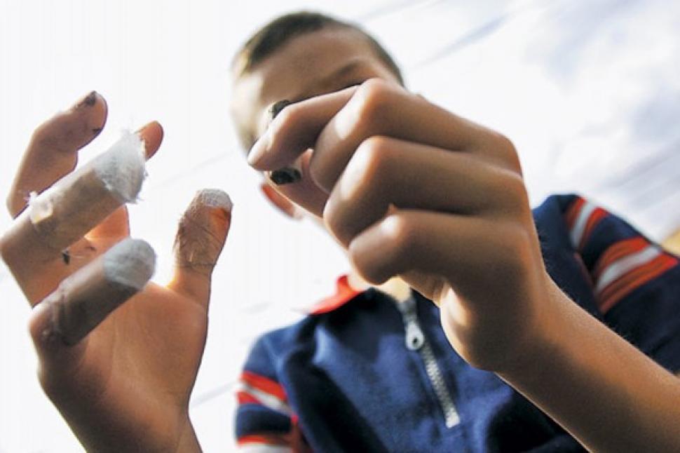 Niño de 4 años pierde dedo de la mano por un cebollón