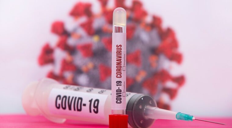 Suman otros 74 casos positivos de COVID-19 en una semana