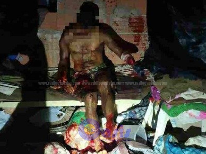 Con machete y cuchillo atacan a hombre en Ponta PorÍ£