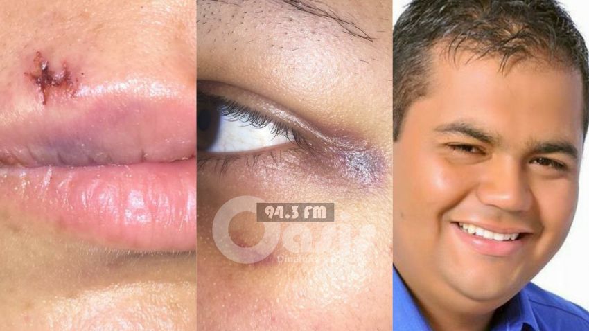 Denuncian a Concejal Municipal de Pedro Juan nuevamente por violencia familiar.