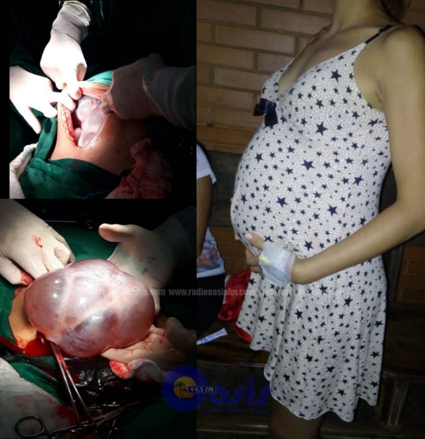 PEDIDO DE SOLIDARIDAD: TUMOR GIGANTE