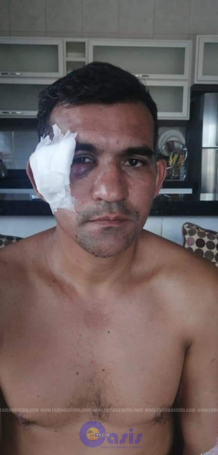 Abogado que sufrió atentado en Pedro Juan se resguarda en casa de exgobernador de Amambay