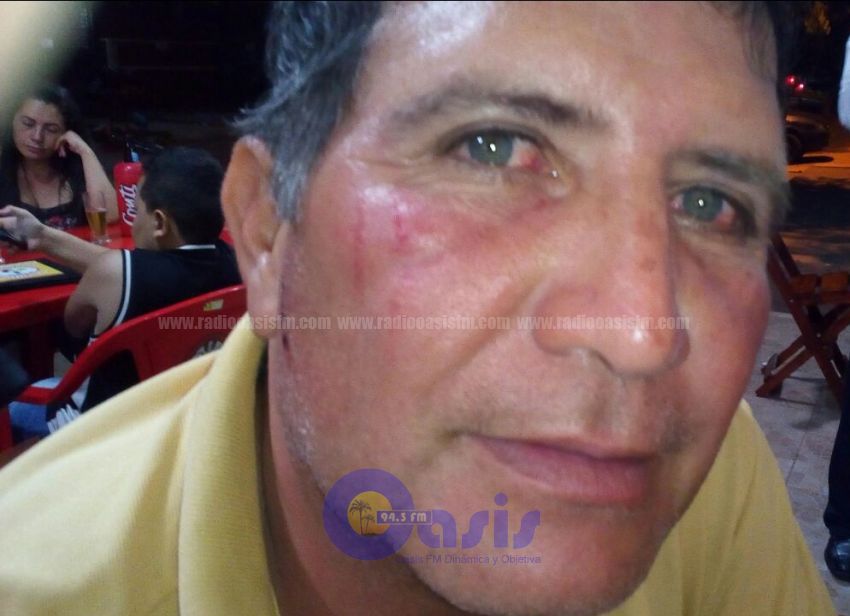 Funcionario de la Gobernación fue garroteado por sus propios correligionarios