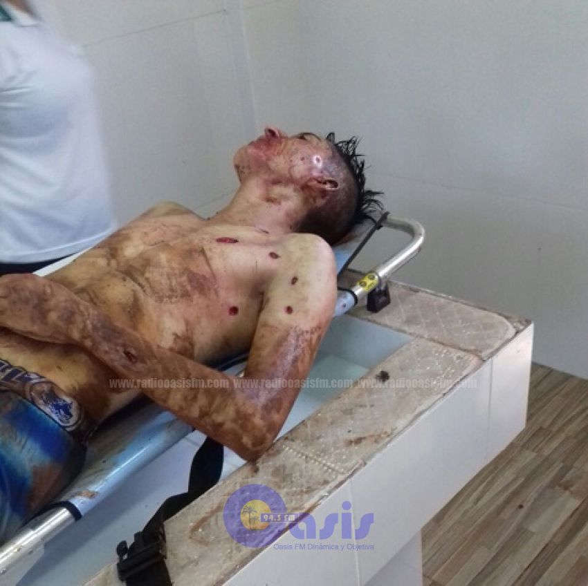 Delincuente muere tras tiroteo con la Policía en Capitán Bado