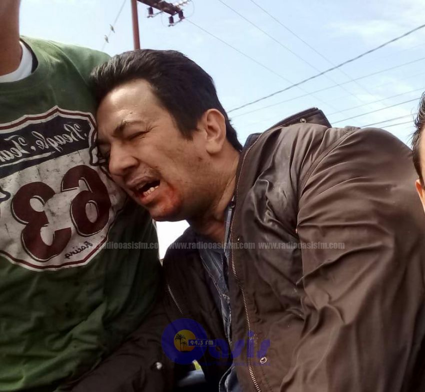 Intento de homicidio en Pedro Juan