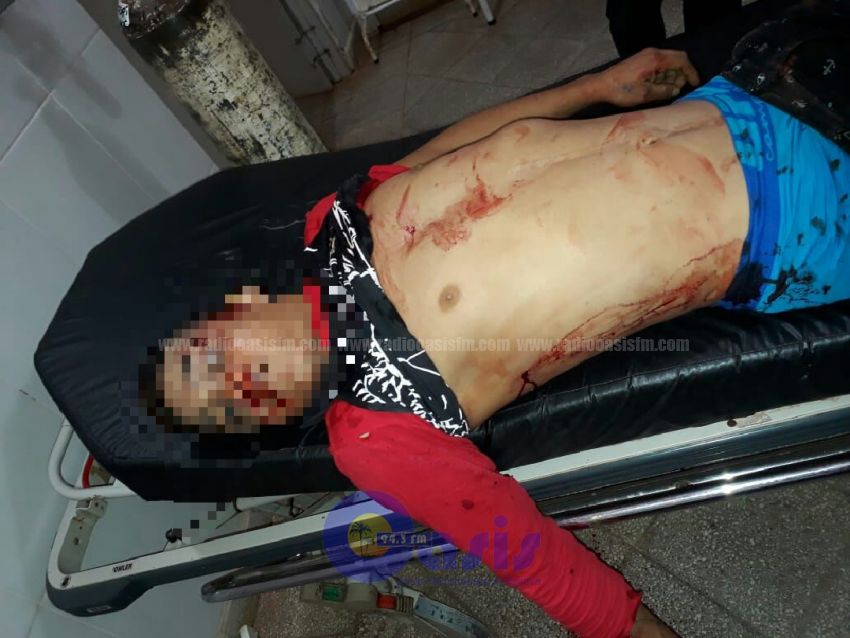 Menor fue asesinado y dos personas quedaron heridas en Yby Yau