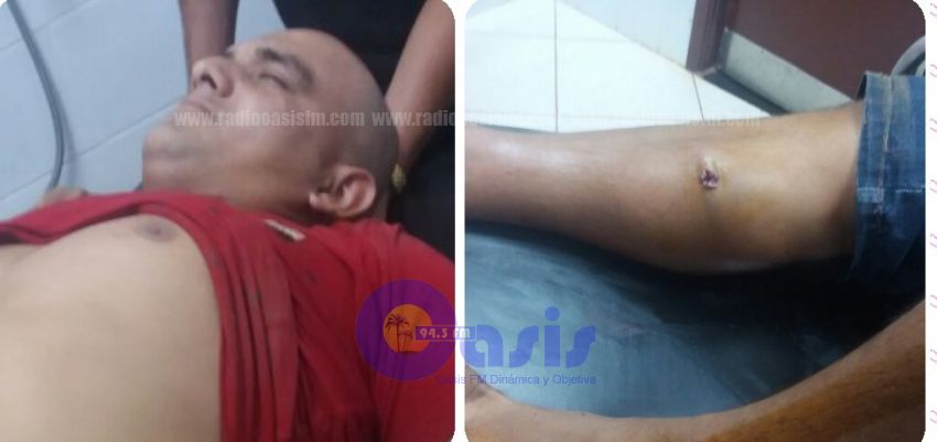 Hieren a un hombre con disparo de 9mm en Capitán Bado