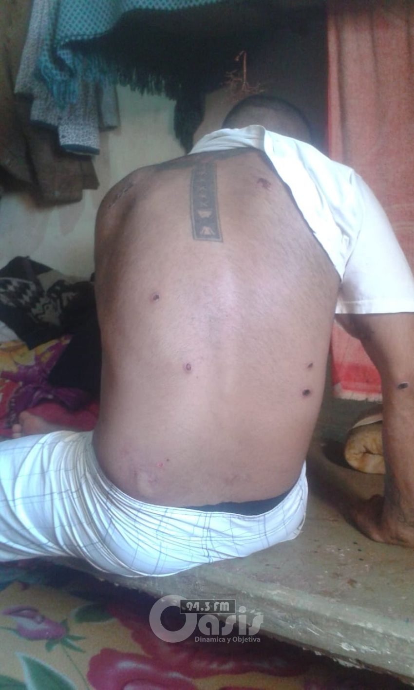 Denuncian brutal golpiza a recluso en cárcel de Pedro Juan