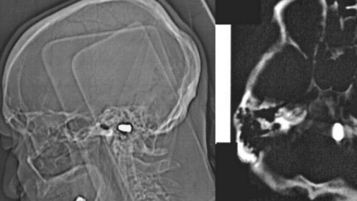 ''Pido oración por Ruhama'' dice mamá de la pequeña víctima de bala perdida
