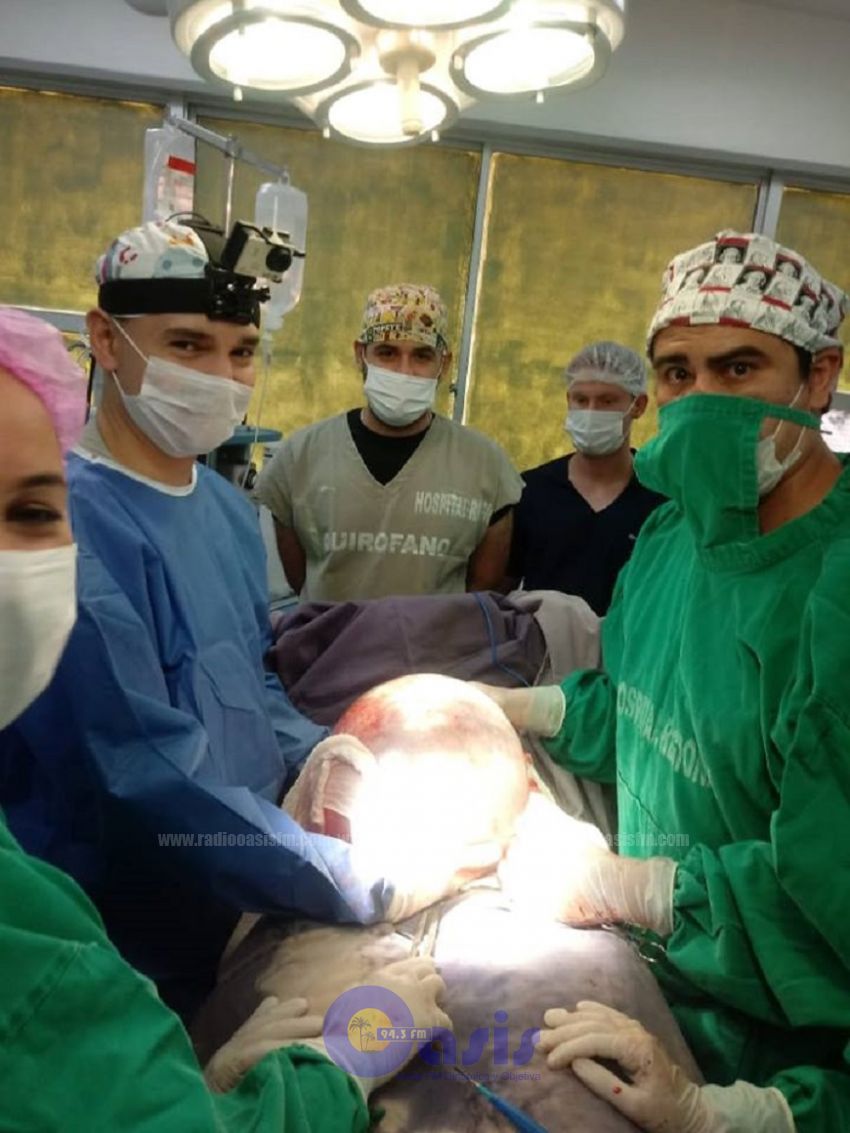 Extirpan Tumor Gigante En El Hospital Regional De Pedro Juan Caballero