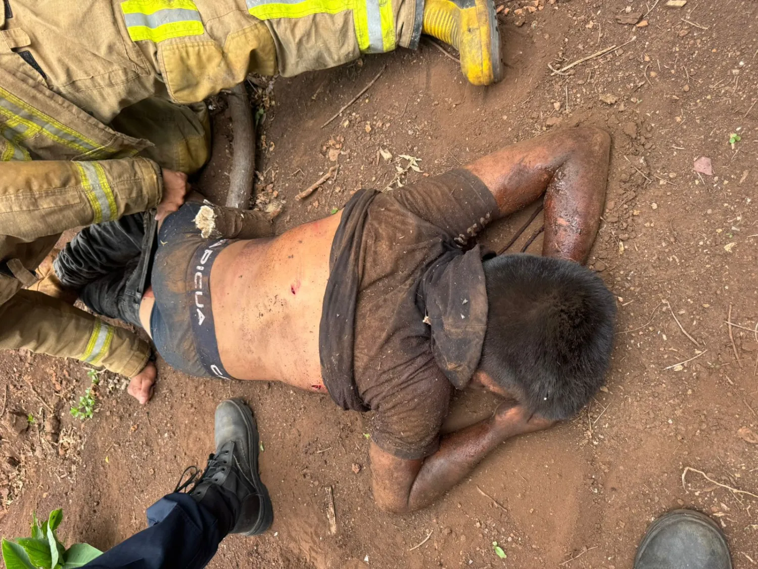 Joven resulta gravemente herido tras ataque con arma blanca en asentamiento Romero Cue
