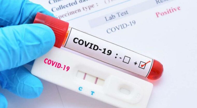 Salud reporta más de 4.300 nuevos casos positivos de COVID-19 en una semana