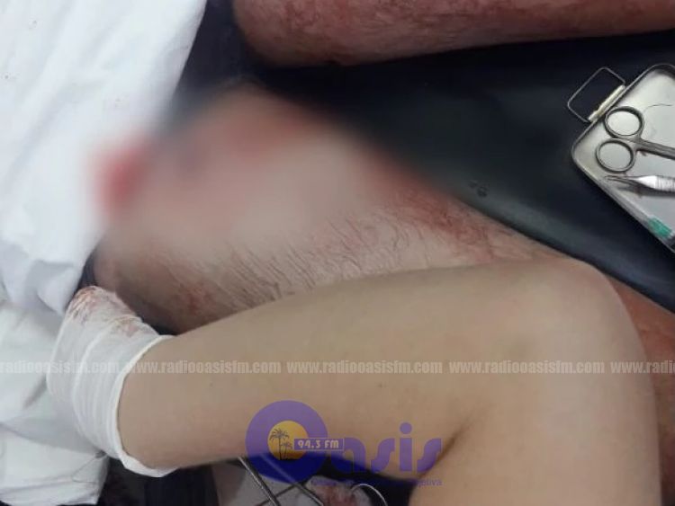 Hieren a tiros a un hombre en Capitán Bado