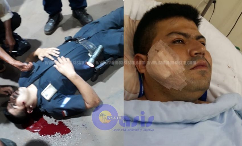 Disparan a un policía en el rostro