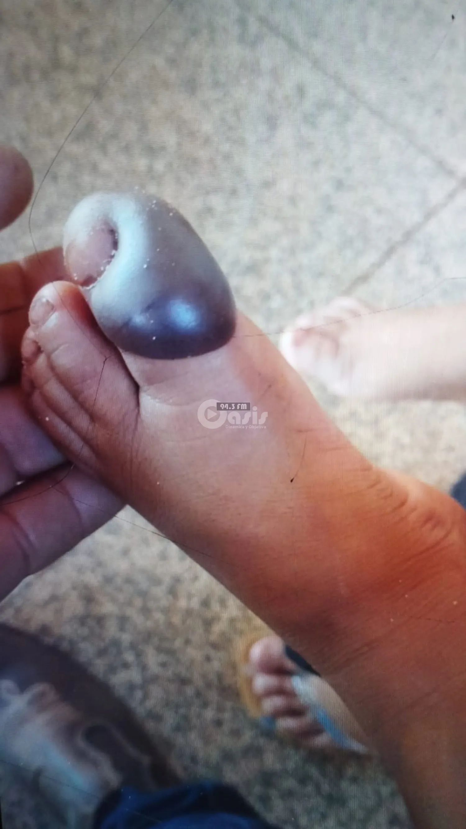 Niño es mordido por una yarará en Bella Vista Norte y permanece bajo observación médica