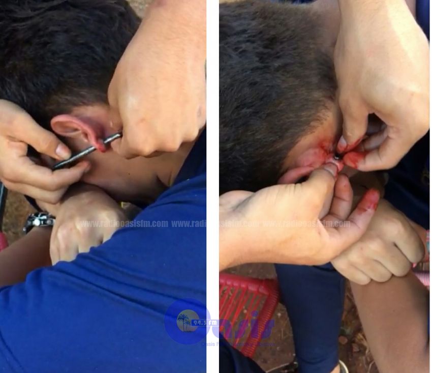 Alumno de un  colegio de PJC agujerea con clavo la oreja de su compañero