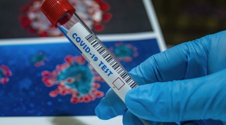 Confirman 76 casos positivos de COVID-19 y un nuevo fallecido