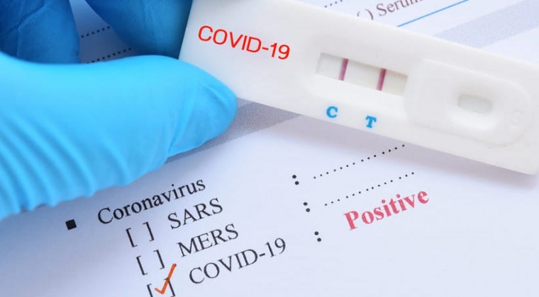 COVID-19: se registran casos y hospitalizaciones