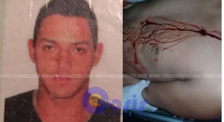 Se resistió a entregar su celular y fue herido de bala en Pedro Juan