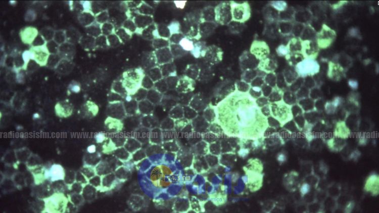 Coronavirus, la enfermedad que se extiende por Asia y el mundo