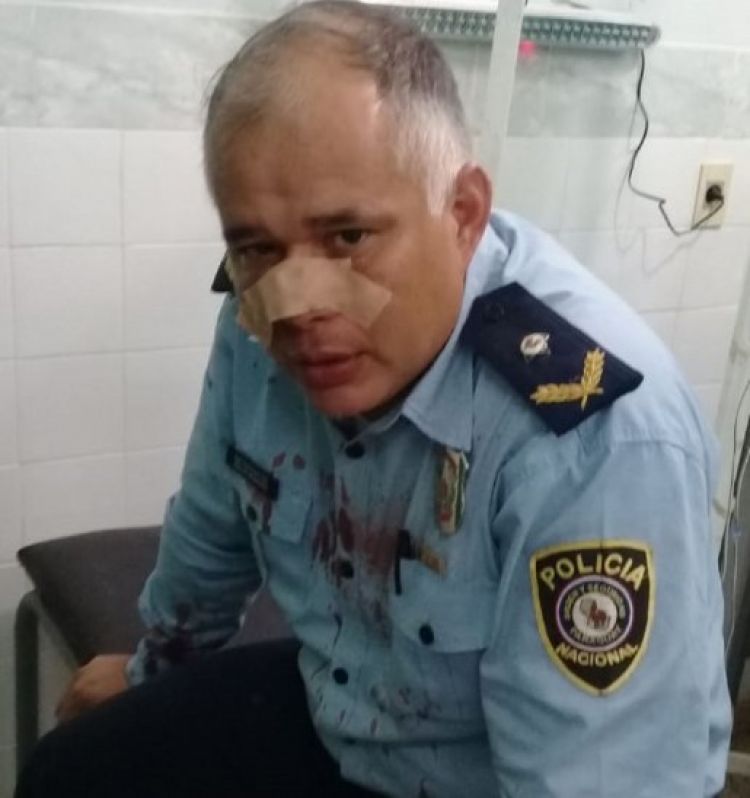 Yaguarón: Policías heridos tras pelea entre hinchas de fútbol