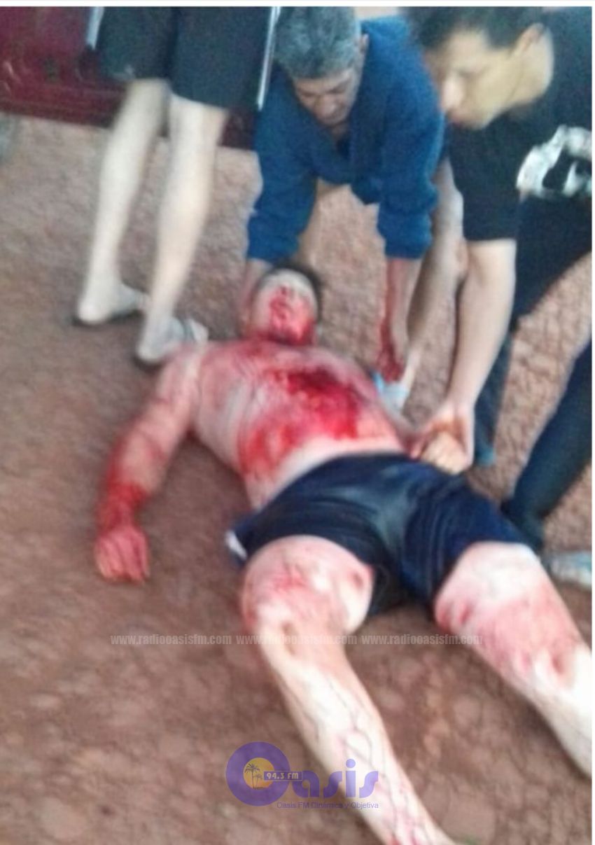 Intento de Homicidio en Pedro Juan Caballero