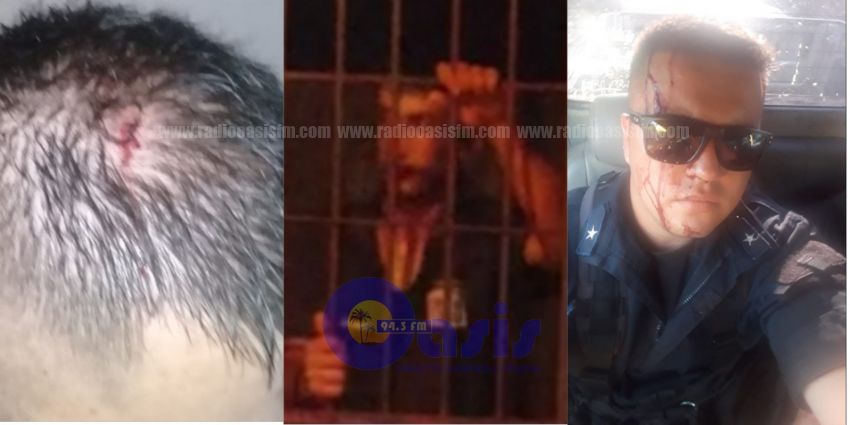 Vecinos defendieron a delincuente garroteando a policías en Pedro Juan