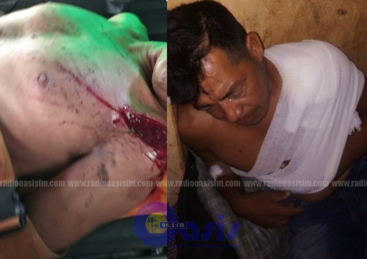 Pelea por celos deja heridos en Pedro Juan