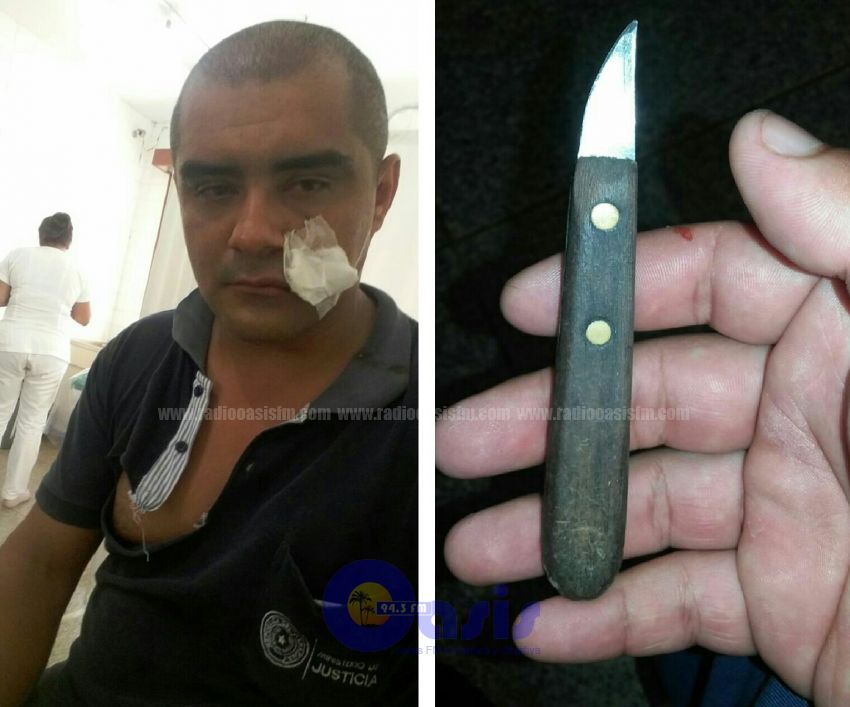 Guardia cárcel fue atacado por recluso con cuchillo en PJC