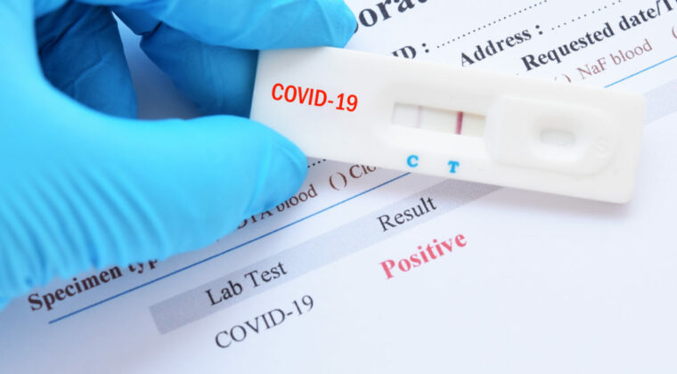 SALUD: No reportan nuevos fallecidos por COVID-19