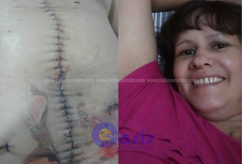 Denuncian negligencia médica en el Hospital Regional de PJC luego de fallecimiento de una mujer