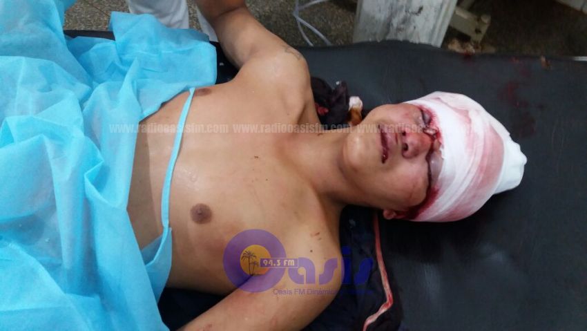 Menor fue herido en la cabeza en Pedro Juan