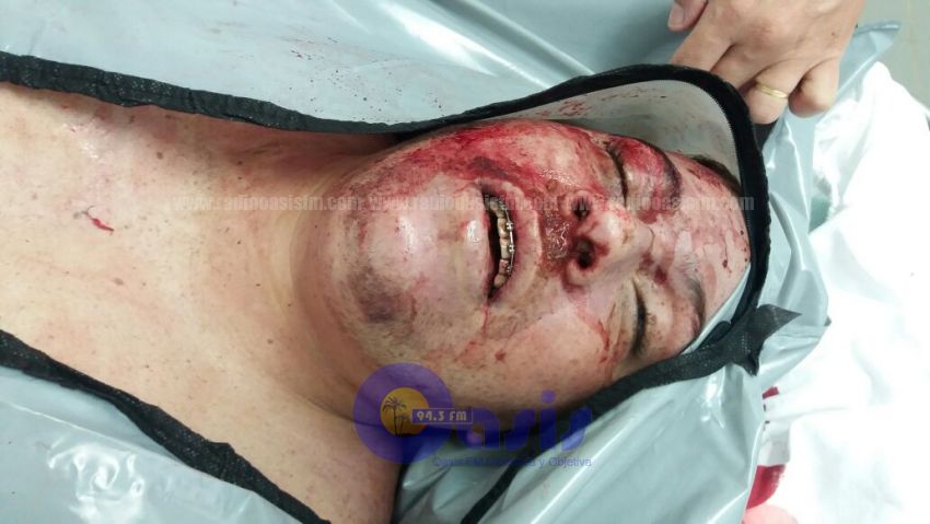 Enfrentamiento  con la Policía  Civil deja un fallecido y un herido  en Ponta Pora