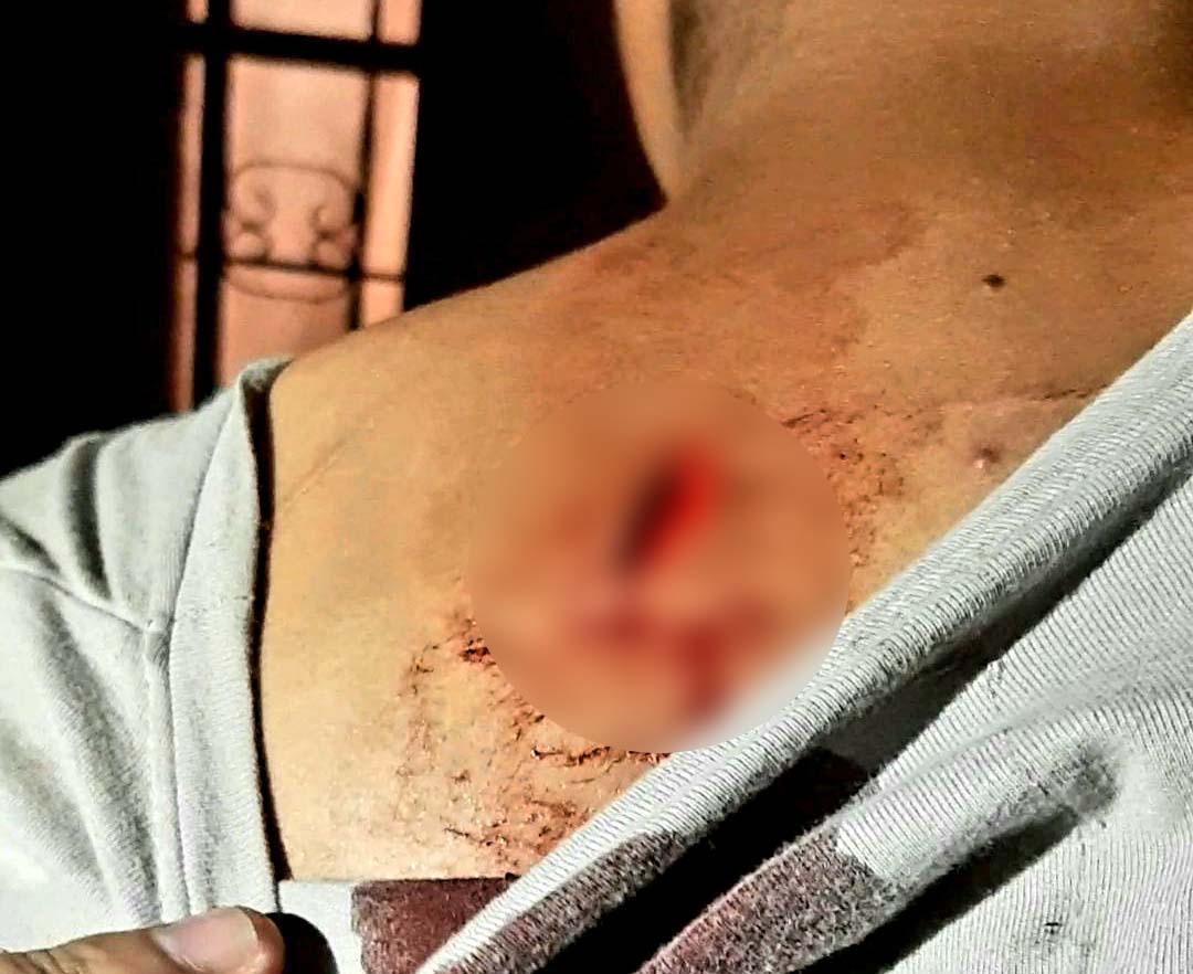 Joven relató que fue herida con arma blanca por su cuñado