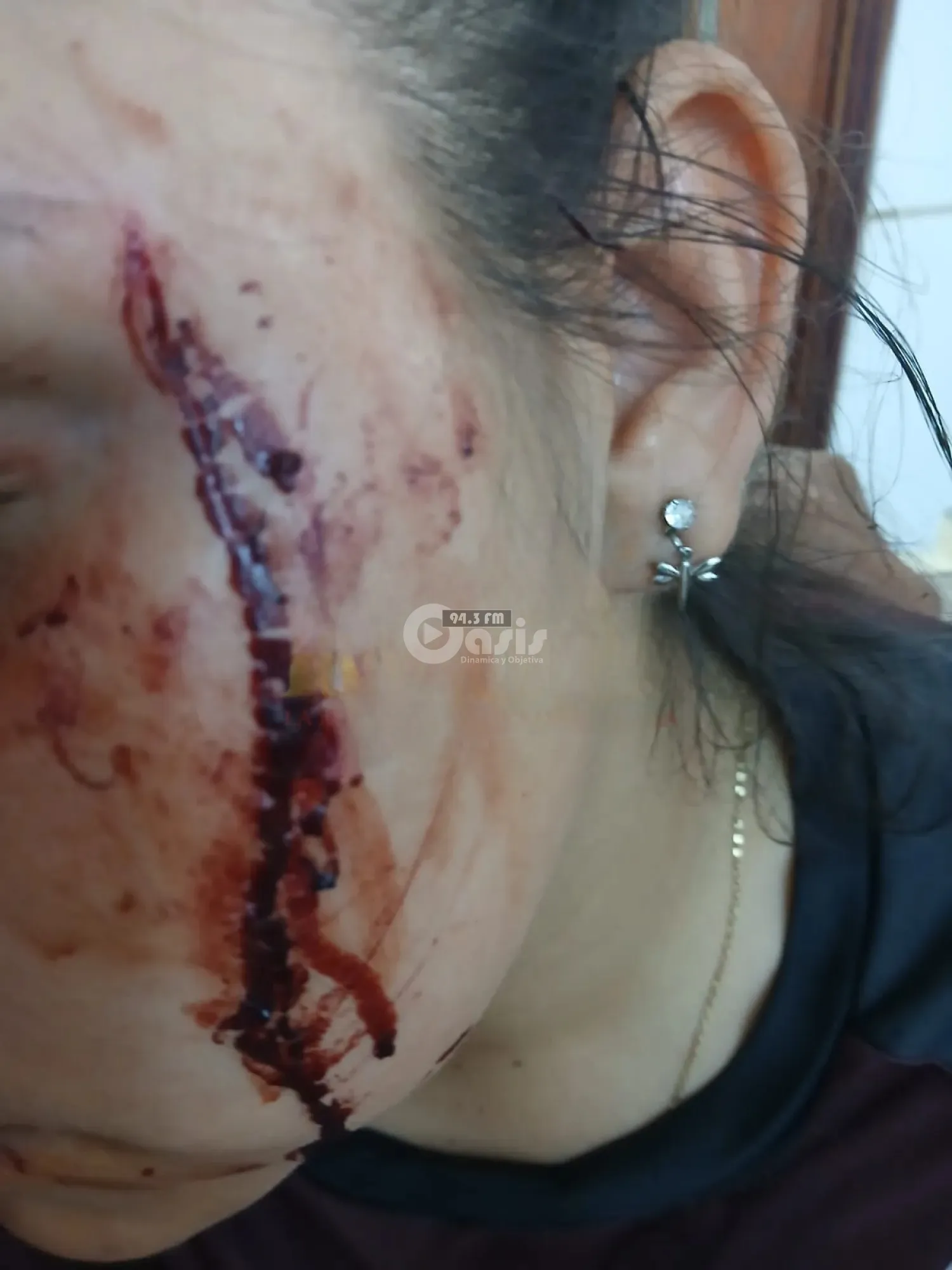Joven es golpeada y asaltada por motochorros en Pedro Juan