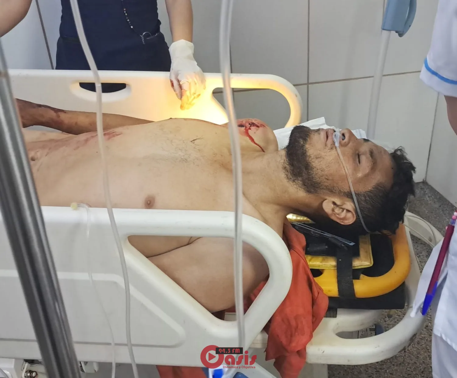 Atacan a tiros a un mecánico en zona rural de Zanja Pytã